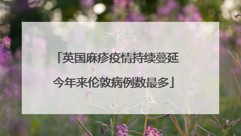 英国麻疹疫情持续蔓延 今年来伦敦病例数最多